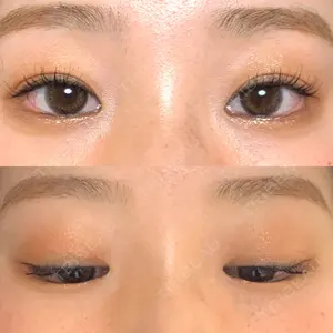 R.O.clinic口コミ