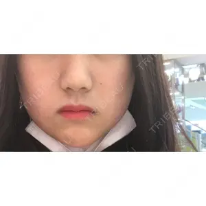 口コミ