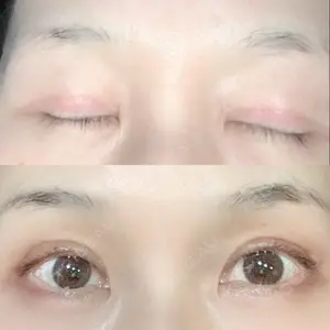 口コミ