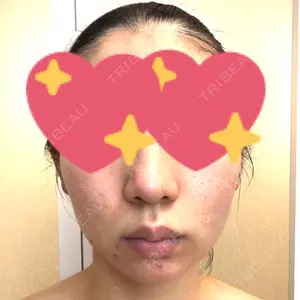 湘南美容クリニック 湘南美容クリニック 新宿本院口コミ