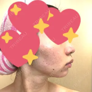 湘南美容クリニック 湘南美容クリニック 新宿本院口コミ
