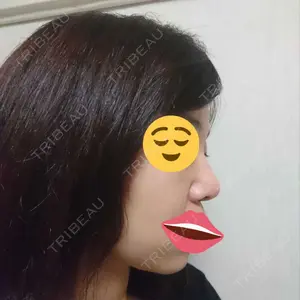 リッツ美容外科 大阪院口コミ