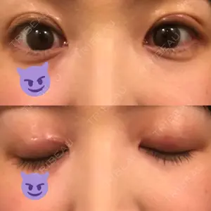 口コミ