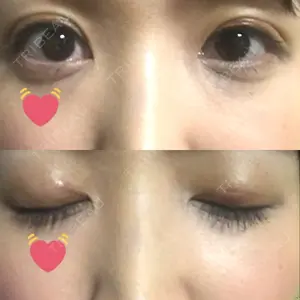 口コミ