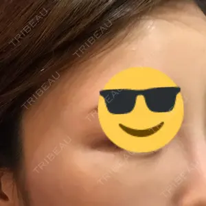 東京イセアクリニック口コミ