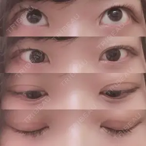口コミ