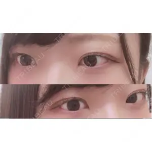 口コミ