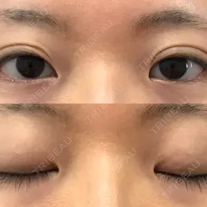 口コミ