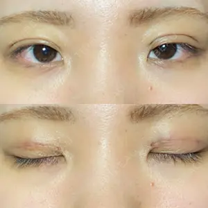 R.O.clinic口コミ