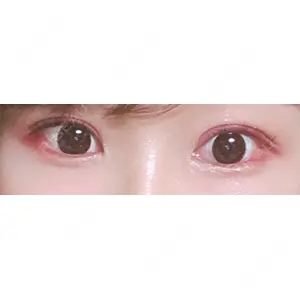 松下皮フ形成外科口コミ