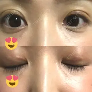 口コミ