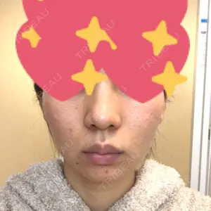 湘南美容クリニック 湘南美容クリニック 新宿本院口コミ