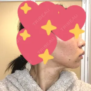 湘南美容クリニック 湘南美容クリニック 新宿本院口コミ