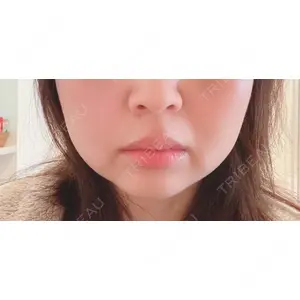 TCB東京中央美容外科 TCB東京中央美容外科 中野院口コミ