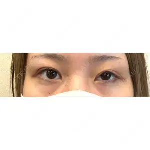口コミ
