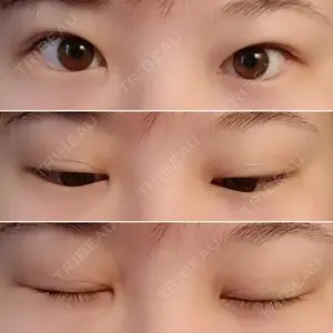 口コミ