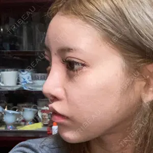 HANABI整形外科口コミ