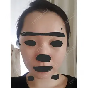 ボンディ美容整形外科（旧リオン整形外科）口コミ