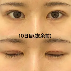 口コミ