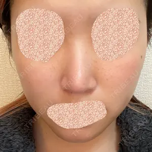 リッツ美容外科 大阪院口コミ