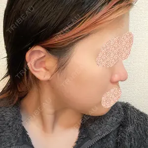 リッツ美容外科 大阪院口コミ