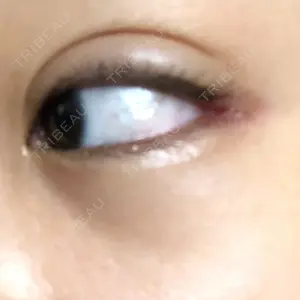 プロミス整形外科口コミ