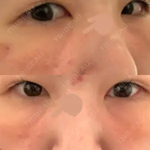 湘南美容クリニック 湘南美容クリニック 金山院口コミ