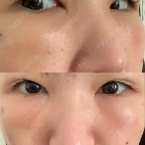 湘南美容クリニック 湘南美容クリニック 金山院口コミ