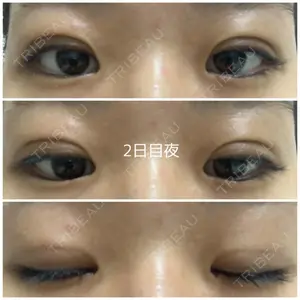 湘南美容クリニック 湘南美容クリニック 金山院口コミ