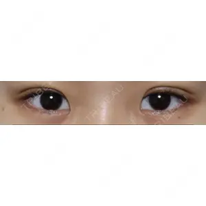 TCB東京中央美容外科 TCB東京中央美容外科 梅田茶屋町院口コミ