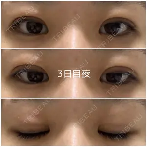 湘南美容クリニック 湘南美容クリニック 金山院口コミ