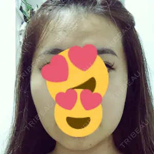 ボンディ美容整形外科（旧リオン整形外科）口コミ