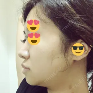 ボンディ美容整形外科（旧リオン整形外科）口コミ