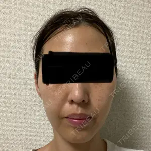 湘南美容クリニック 湘南美容クリニック 秋葉原院口コミ