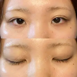 R.O.clinic口コミ