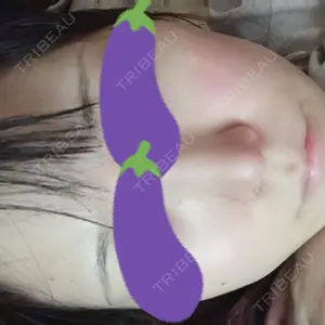 TCB東京中央美容外科 TCB東京中央美容外科 渋谷東口院口コミ