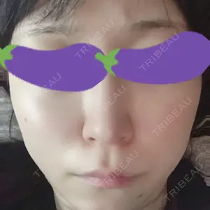 TCB東京中央美容外科 TCB東京中央美容外科 渋谷東口院口コミ