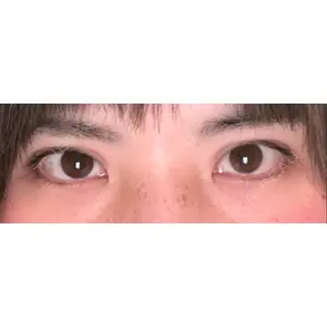 TCB東京中央美容外科 TCB東京中央美容外科 町田院口コミ