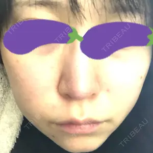 TCB東京中央美容外科 TCB東京中央美容外科 渋谷東口院口コミ