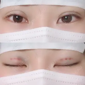 湘南美容クリニック 湘南美容クリニック 小倉院口コミ