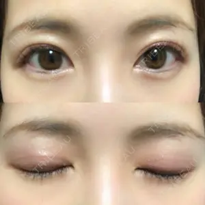 口コミ