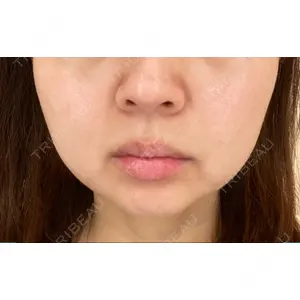 TCB東京中央美容外科 TCB東京中央美容外科 中野院口コミ