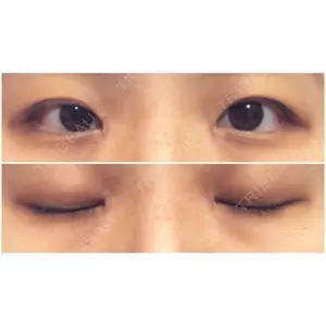 東京BELLEZZAクリニック口コミ