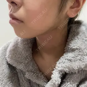 口コミ