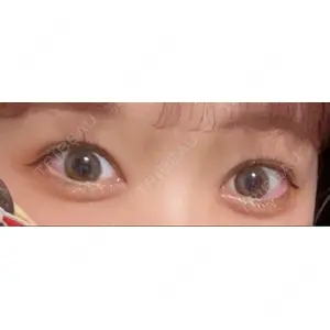 口コミ