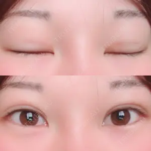 湘南美容クリニック 湘南美容クリニック 小倉院口コミ