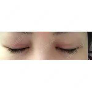 いちのせ形成外科・皮膚科 眼瞼＆フェイスクリニック口コミ