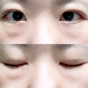 湘南美容クリニック 湘南美容クリニック 池袋東口院口コミ