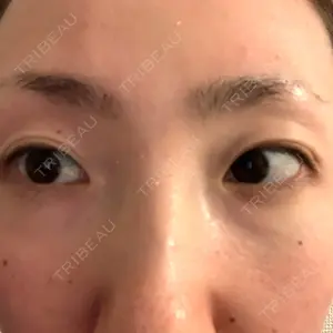 ルネッサンス美容外科医院 ルネッサンス美容外科医院 東京院口コミ