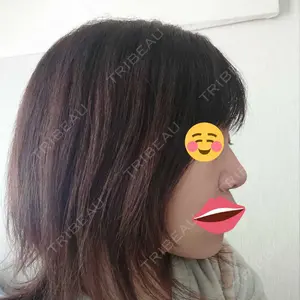 リッツ美容外科 大阪院口コミ